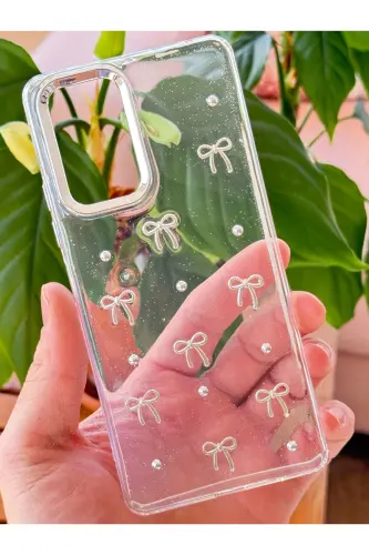 Redmi Note 10 Pro Kılıf Fiyonk Desenli Şeffaf Simli Gümüş Kamera Çıkıntılı Parlak Kapak-Lensli Fiyonk - 4