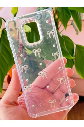 Redmi Note 9 Pro/9S Kılıf Fiyonk Desenli Şeffaf Simli Gümüş Kamera Çıkıntılı Parlak Kapak-Lensli Fiyonk - FIBAKS (1)
