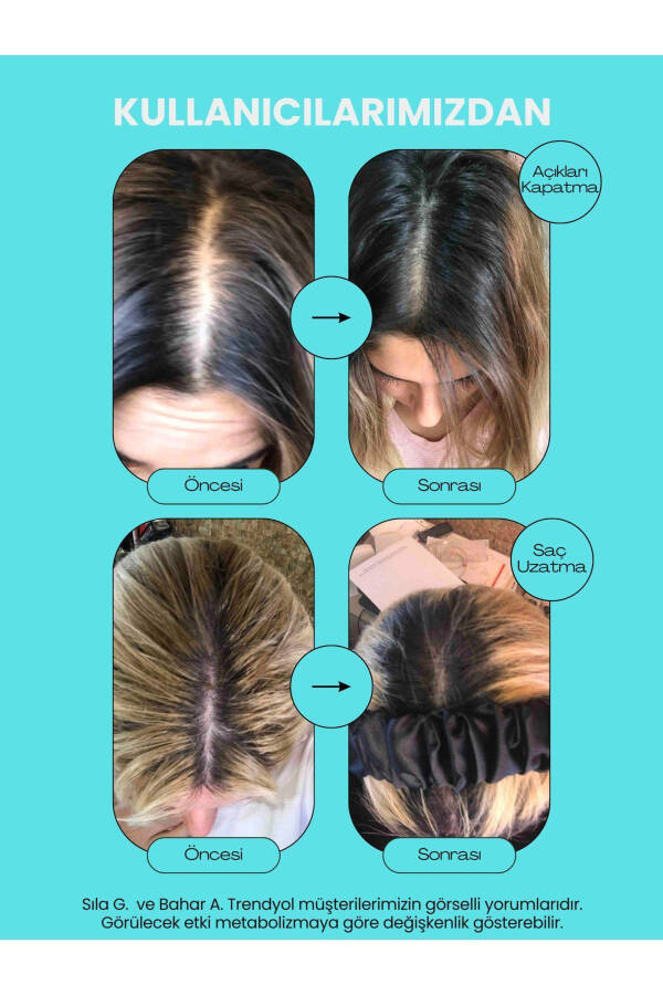 Saç ve Tırnak Vitamini - Hair Vitamin B Complex - Biotin Tablet Keratin Selenyum Çinko - Dökülmesine - 11