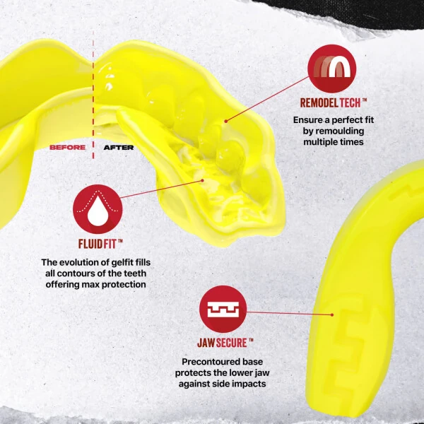 SAFEJAWZ Sports Mouthguard Slim Fit, Adults and Junior Mouth Guard with Case (Yellow, Adult (+12 Years))-YELLOW - 3