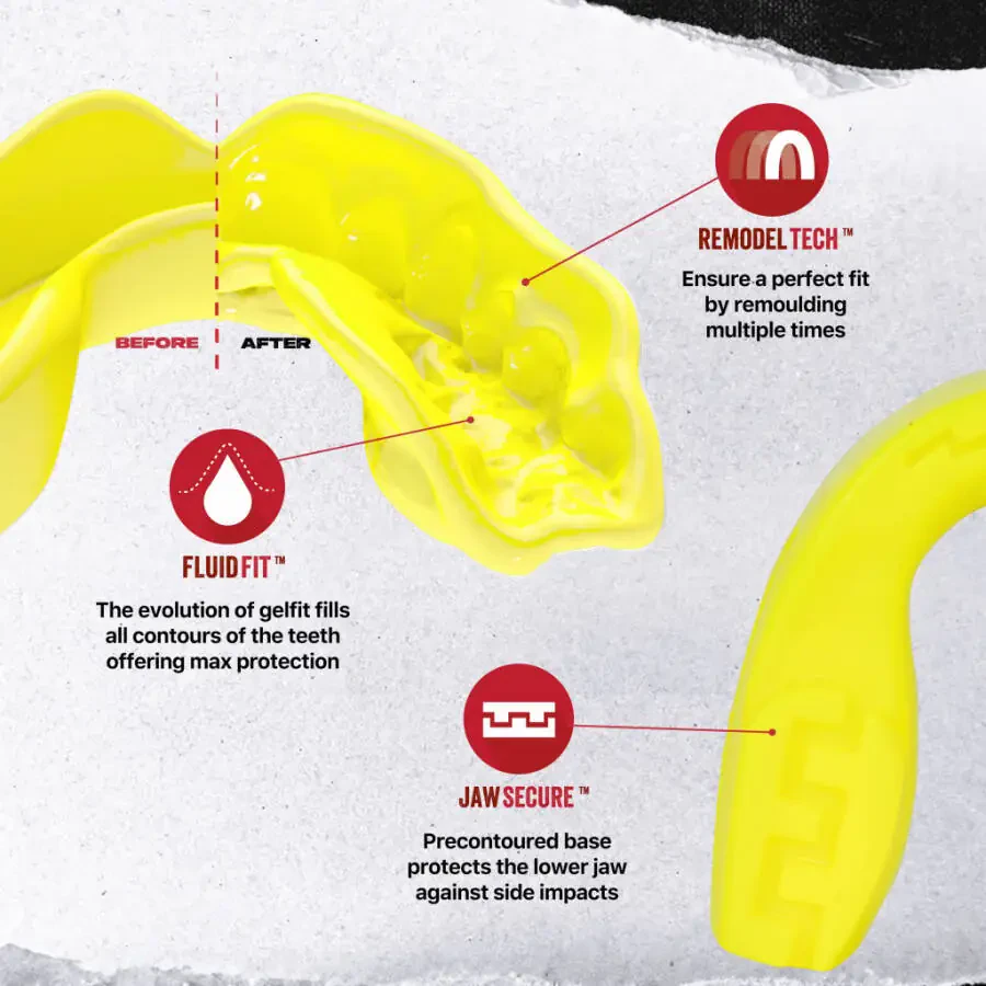 SAFEJAWZ Mouthguard Slim Fit, Adults and Junior Mouth Guard with Case for Boxing, Basketball, Lacrosse, Football, MMA, Martial Arts, Hockey and All Contact Sports (Yellow, Senior (12+ y - 3