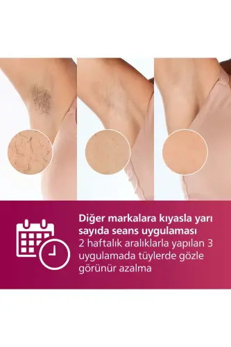 Sc1997/00 Lumea Lazer Epilatsiya Ipl Soch Olish Asbob, Sumka Sovg'a Qilingan, Qo'shimcha Uzun Kabel - 4