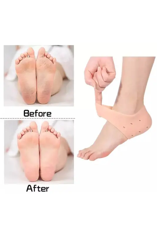 Silicone Heel Lining Heel Spur Crack Protector Heel Softener-Coffee - 7