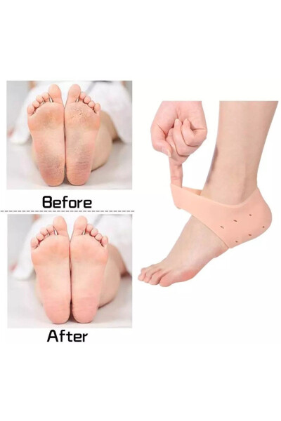 Silicone Heel Socks Heel Spur Crack Protector Heel Softener - 8