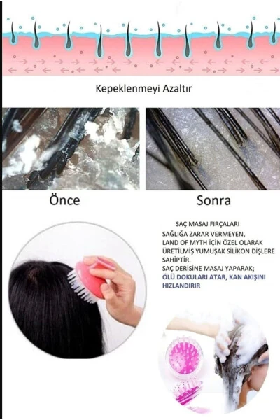 Silikon Bosh Terapiyasi Soch Yuvish Cho'tkasi Cho'tkasi | Terapiya Qiluvchi Shampo Cho'tkasi Dush Cho'tkasi - 4