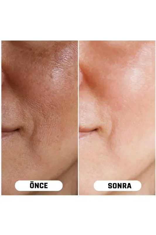 Skin Tone Evener Anti-Spot C Vitamin 10% Hyaluronic Acid Brightening Moisturizing Skin Serum - 6