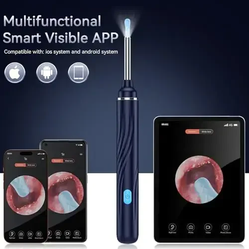 Tomaje Ear Wax Removal Tool Camera, Ear Cleaner with Camera, 1080P HD Ear Camera and 6 LED Light, Ear Wax Removal Kit with 6 Ear Pick, 6 Pcs Ear Set, Ear Camera Wax Removal for iOS & Android, Blue - 4