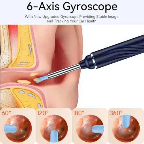Tomaje Ear Wax Removal Tool Camera, Ear Cleaner with Camera, 1080P HD Ear Camera and 6 LED Light, Ear Wax Removal Kit with 6 Ear Pick, 6 Pcs Ear Set, Ear Camera Wax Removal for iOS & Android, Blue - 6