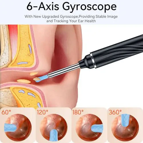 Tomaje Ear Wax Removal Tool Camera, Ear Cleaner with Camera, 1080P HD Ear Camera and 6 LED Light, Ear Wax Removal Kit with 6 Ear Picks, 6 Pcs Ear Set, Ear Camera Wax Removal for iOS & Android, Black - 6