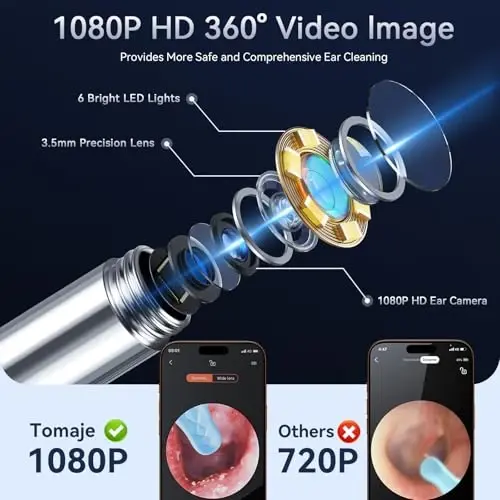 Tomaje Ear Wax Removal Tool Camera, Ear Cleaner with Camera, 1080P HD Ear Camera and 6 LED Light, Ear Wax Removal Kit with 6 Ear Pick, 6 Pcs Ear Set, Ear Camera Wax Removal for iOS & Android, Blue - 2