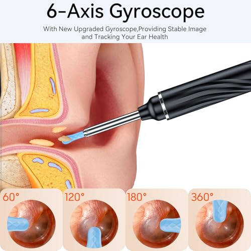 Tomaje Ear Wax Removal Tool Camera, Ear Cleaner with Camera, 1080P HD Ear Camera and 6 LED Light, Ear Wax Removal Kit with 6 Ear Pick, 6 Pcs Ear Set, Ear Camera Wax Removal for iOS & Android, Black - 6