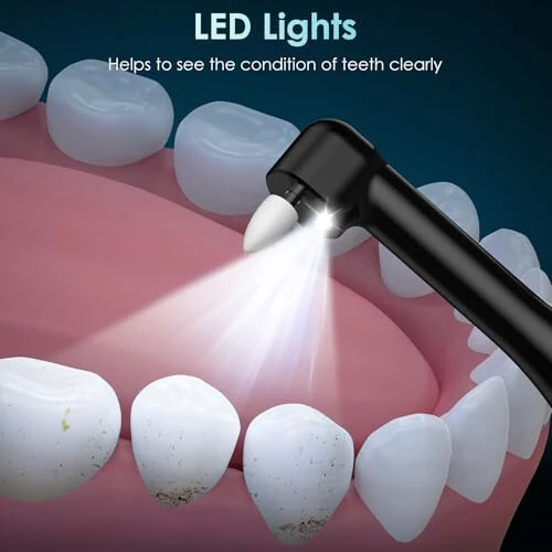 Tooth Polisher, Rechargeable Teeth Polisher with 5 Brush Heads, 4 Speed Modes, Dental Polisher for Whitening and Polishing, LED Light, 3 Polish Pastes, IPX6 Waterproof Teeth Cleaning Tools, Black - 4
