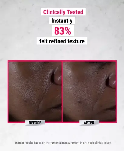 Ultra Pure Yuqori Potensialli 9.8% Glikolik Kislota Serumi, 1 oz. - 4