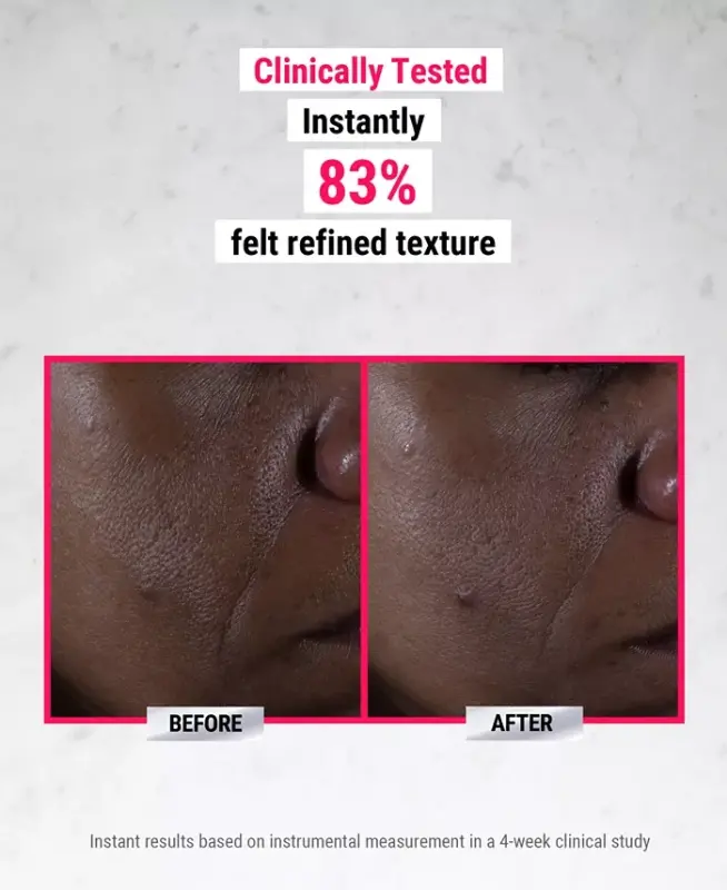 Ultra Pure Yuqori Potensialli 9.8% Glikolik Kislota Serumi, 1 oz. - 4