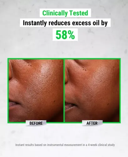 Ultra Pure High-Potency 5.0% Niacinamide Serum, 1 oz. - No Color - 5