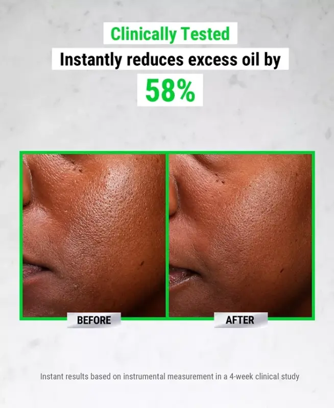 Ultra Pure High-Potency 5.0% Niacinamide Serum, 1 oz. - No Color - 5