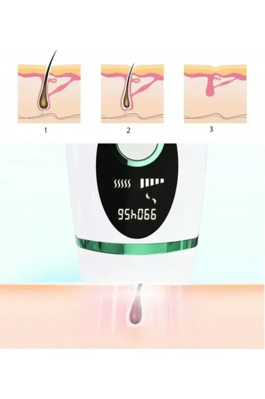 Xiaomi Inface ZH-01D IPL Epilator Device Green - 6